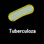 tuberculoza